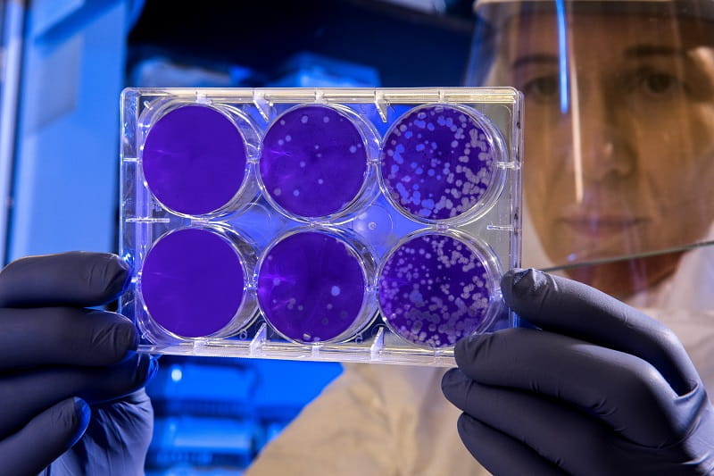 Eine Ärztin untersucht Virenkulturen in Petrischalen. 