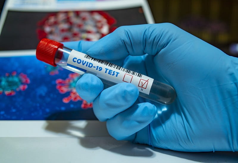 Ein Covid-19-Testergebnis in der Hand eines Virologen.