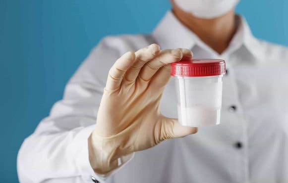 Hand mit medizinischem Gummihandschuh zeigt Behälter mit weißer Flüssigkeit.